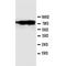 Calpain-1 catalytic subunit antibody, orb27577, Biorbyt, Western Blot image 