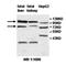 Zinc Finger Protein 184 antibody, orb77986, Biorbyt, Western Blot image 