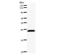 Zinc Finger E-Box Binding Homeobox 1 antibody, LS-C342536, Lifespan Biosciences, Western Blot image 