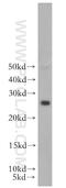 RAB41, Member RAS Oncogene Family antibody, 18818-1-AP, Proteintech Group, Western Blot image 