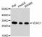 Voltage Dependent Anion Channel 1 antibody, STJ113041, St John