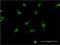 SRC Proto-Oncogene, Non-Receptor Tyrosine Kinase antibody, H00006714-M01, Novus Biologicals, Immunofluorescence image 