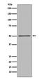 Forkhead Box A1 antibody, M00266-1, Boster Biological Technology, Western Blot image 