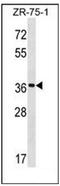 Fucosyltransferase 9 antibody, AP51741PU-N, Origene, Western Blot image 