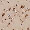 Toll Like Receptor 7 antibody, NB100-56588, Novus Biologicals, Immunohistochemistry paraffin image 