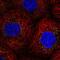 Perilipin 3 antibody, HPA066538, Atlas Antibodies, Immunofluorescence image 