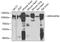 Rho GTPase Activating Protein 44 antibody, GTX32841, GeneTex, Western Blot image 