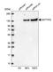 Deoxynucleotidyltransferase Terminal Interacting Protein 2 antibody, HPA044502, Atlas Antibodies, Western Blot image 