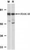 Interleukin 1 Receptor Associated Kinase 3 antibody, NBP1-76782, Novus Biologicals, Western Blot image 