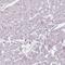 AB1IP antibody, NBP2-39009, Novus Biologicals, Immunohistochemistry paraffin image 