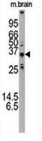 Autophagy Related 5 antibody, abx030046, Abbexa, Immunohistochemistry frozen image 