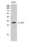 Interleukin 15 Receptor Subunit Alpha antibody, LS-C384090, Lifespan Biosciences, Western Blot image 