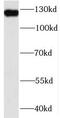 MutS Homolog 3 antibody, FNab05373, FineTest, Western Blot image 