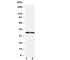 Insulin Like Growth Factor Binding Protein 1 antibody, R30552, NSJ Bioreagents, Western Blot image 