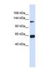 Regulator Of G Protein Signaling 22 antibody, NBP1-56546, Novus Biologicals, Western Blot image 