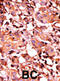 Interleukin 1 Receptor Type 1 antibody, abx031870, Abbexa, Immunohistochemistry paraffin image 