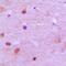 Regulator Of Chromosome Condensation 2 antibody, orb215225, Biorbyt, Immunohistochemistry paraffin image 