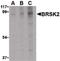 BR Serine/Threonine Kinase 2 antibody, PA5-20358, Invitrogen Antibodies, Western Blot image 