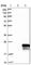 Solute Carrier Family 51 Beta Subunit antibody, HPA008533, Atlas Antibodies, Western Blot image 