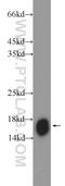 NADH:Ubiquinone Oxidoreductase Subunit B5 antibody, 23855-1-AP, Proteintech Group, Western Blot image 