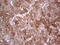 Pyrophosphatase (Inorganic) 2 antibody, M06587, Boster Biological Technology, Immunohistochemistry paraffin image 