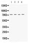 Potassium Voltage-Gated Channel Subfamily A Member 4 antibody, PA5-79550, Invitrogen Antibodies, Western Blot image 