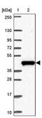Chromosome 19 Open Reading Frame 54 antibody, PA5-63648, Invitrogen Antibodies, Western Blot image 