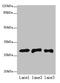 ETHE1 Persulfide Dioxygenase antibody, CSB-PA007847HA01HU, Cusabio, Western Blot image 