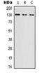 Nucleolar Protein 8 antibody, orb339043, Biorbyt, Western Blot image 