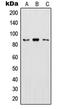 Inhibitor Of Nuclear Factor Kappa B Kinase Subunit Beta antibody, MBS820554, MyBioSource, Western Blot image 