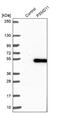 Proteasome 26S Subunit, Non-ATPase 11 antibody, NBP1-82700, Novus Biologicals, Western Blot image 