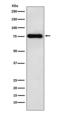 Metadherin antibody, M04060, Boster Biological Technology, Western Blot image 