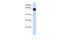 T-Box 18 antibody, 25-348, ProSci, Enzyme Linked Immunosorbent Assay image 