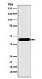 Interleukin Enhancer Binding Factor 2 antibody, M04443-1, Boster Biological Technology, Western Blot image 