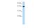 Bestrophin 4 antibody, PA5-68693, Invitrogen Antibodies, Western Blot image 