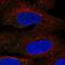 Transmembrane Protein 68 antibody, NBP1-82000, Novus Biologicals, Immunocytochemistry image 