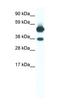 Thyroid Hormone Receptor Beta antibody, orb329840, Biorbyt, Western Blot image 