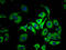 ATP Citrate Lyase antibody, CSB-RA712206A0HU, Cusabio, Immunofluorescence image 