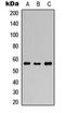 DNA Methyltransferase 3 Alpha antibody, orb234826, Biorbyt, Western Blot image 