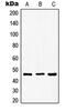 Glycogen Synthase Kinase 3 Beta antibody, MBS820273, MyBioSource, Western Blot image 