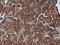 Mitogen-Activated Protein Kinase Kinase 1 antibody, LS-C337958, Lifespan Biosciences, Immunohistochemistry paraffin image 