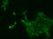 Ribosomal Protein Lateral Stalk Subunit P0 antibody, 203130-T02, Sino Biological, Immunohistochemistry paraffin image 