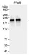 WD Repeat Domain 62 antibody, NB100-77302, Novus Biologicals, Western Blot image 