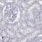 Arachidonate Lipoxygenase 3 antibody, HPA078597, Atlas Antibodies, Immunohistochemistry frozen image 