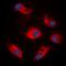 Ribosomal Protein S6 Kinase B1 antibody, orb224000, Biorbyt, Immunofluorescence image 