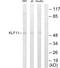 Krueppel-like factor 11 antibody, LS-C118665, Lifespan Biosciences, Western Blot image 