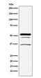 Golgi Associated PDZ And Coiled-Coil Motif Containing antibody, M03660-1, Boster Biological Technology, Western Blot image 