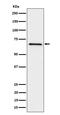 G Protein-Coupled Receptor Kinase 6 antibody, M03623, Boster Biological Technology, Western Blot image 