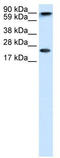 Chromobox 5 antibody, TA330563, Origene, Western Blot image 