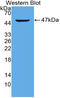 Interleukin-21 antibody, LS-C314821, Lifespan Biosciences, Western Blot image 